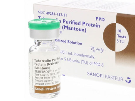 Tuberculin Purified Protein Derivative