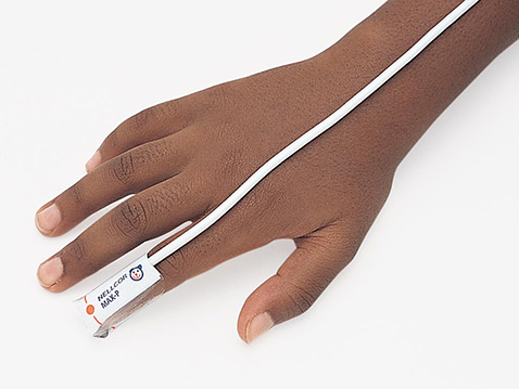 NONIN Onyx Vantage 9590 Finger Pulse Oximeter | Life-Assist